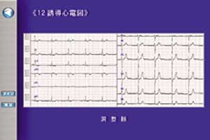 症例により心電図が表示されます。